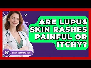 Are Lupus Skin Rashes Painful or Itchy? | Lupus Wellness Guide