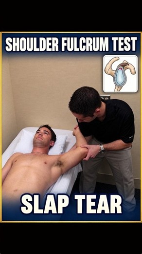 Shoulder Fulcrum Test for Anterior Instability 🦴 #Shorts #shoulderpain #physio #orthopedics #ATC
