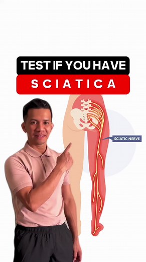 78K views · 1.8K reactions | Testing for sciatica: Listen to your...