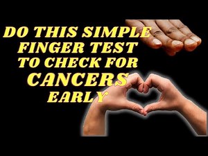 The Simple Finger Test To Detect Cancer Early | Finger Clubbing