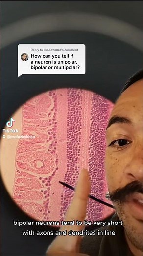 unipolar vs. bipolar vs. multipolar neurons