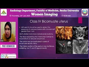 Mullerian Duct Anomalies:How to diagnose