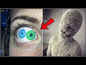 20 People With Bizarre Bodies That Defy Science & Nature! | Then and Now 2026