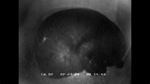 Listen to this hibernating black bear snore its head off.