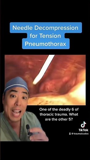 Needle decompression for a tension pneumothorax