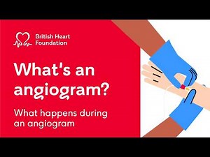 What is an angiogram?
