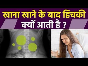 खाना खाने के बाद हिचकी क्यों आती है | Khana khane ke bad hichki kyon aati hai | Boldsky *Health