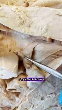 Gia Cerita Anatomi: Eps. Rahim dan Ovarium