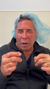 I know a lot of you wanted me to keep you updated, so here it is! Everything is going well so far, just some uncomfortable dry skin from the lasers. Also, I’m going to start working on some things that could help with DNA repair for those of you who have already done some damage to your skin, but want to reduce your risk of getting skin cancer. Thank you for all of the love and support; it means a lot to me! I’ll continue to keep you updated and please remember to wear your sunscreen! ☀️🧴 🔊 So