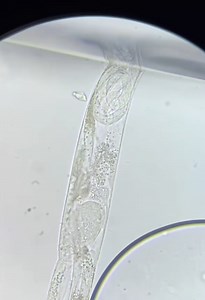 Nematodes and Vinegar Eels Under the Microscope