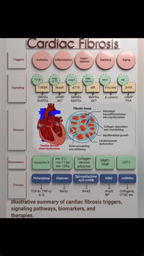 Abdallah Othman on Instagram: "🫀✨ Cardiac Fibrosis Quick Facts Triggers: Ischemia, inflammation, hypertension, genetics, aging Pathways: TGFβ/SMADs, RAAS, WNT/β-catenin, β-adrenergic Biomarkers: Galectin-3, miR-21, miR-133a, collagen peptides, sST2 Therapies: ACEi/ARB, spironolactone, ARNI, anti-TGFβ, miRNA-based Clinical impact: Stiff myocardium, impaired function, heart failure risk 🔍 Early detection + targeted therapy = better outcomes! #Cardiology #Fibrosis #HeartHealth"