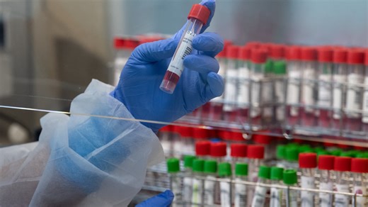 Laboratoires d'analyses: les biologistes en grève à partir de lundi