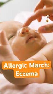 Treating eczema to help stop the “allergic march” | AAP