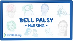 Bell palsy: Nursing: Video & Causes | Osmosis