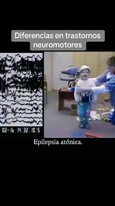 837K views · 13K reactions | Epilepsia 易 Derechos a quien corresponda | 퐂퐨퐥퐞퐠퐢퐨 퐈퐧퐭퐞퐫퐧퐚퐜퐢퐨퐧퐚퐥 퐝퐞 퐂퐢퐞퐧퐜퐢퐚퐬 퐂퐫퐢퐦퐢퐧퐨퐥ó퐠퐢퐜퐚퐬 퐲 퐅퐨퐫퐞퐧퐬퐞퐬 | Facebook