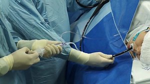 16K views · 134 reactions | Video demonstrating a case of fluid...