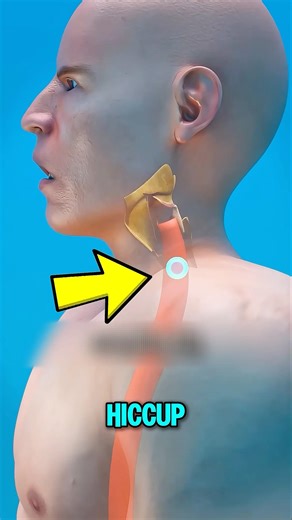 Why Hiccups Make That “Hic” Sound 😳🫁