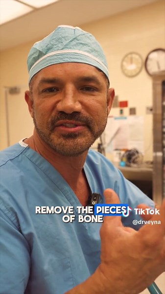 Skull fracture case study - A skull fracture occurs when there’s a break in one of the bones of the skull. Fractures can vary in severity, from hairline cracks to more severe breaks that penetrate the bone. - Depending on the type and location of the fracture, symptoms can range from mild pain and swelling to severe headaches, bleeding from the ears or nose, and neurological deficits. - Treatment usually involves observation, pain management, and in some cases, surgery to repair the fracture and