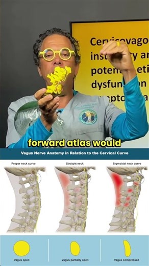 Normal vs. Abnormal neck curve- how is the vagus nerve affected by atlas instability?
