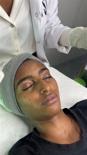 Best Facial Treatments for Various Skin Types