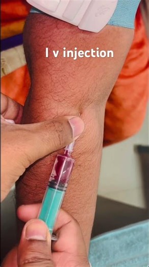 I v Injection technique #viral #nurse #doctor #shorts #reels #trending #injection #world #feed