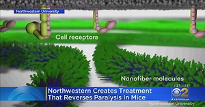 Northwestern Researchers Develop Possible Treatment For Paralysis - CBS Chicago