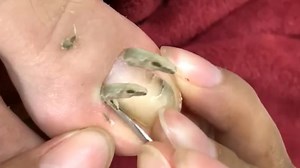 109K views · 1K reactions | Quick pedicure cleaning, manicure techniques | Ingrown toenails | Facebook