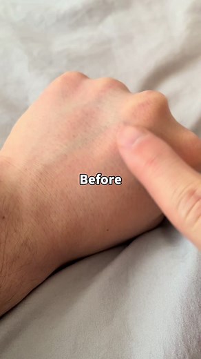 手の毛穴を美しく整える方法