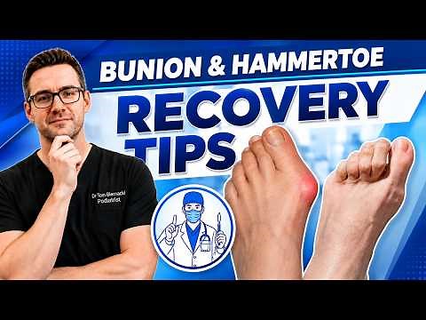 Don't Make These Mistakes After Your Bunion Surgery!