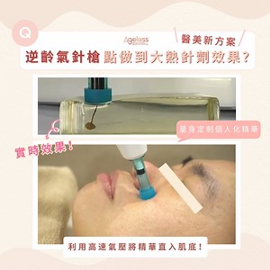 實時睇 #逆齡氣針槍 原理效果✨ Whatsapp查詢熱線📲https://wa.me/message/LVHPCINTCHXUM1 心郁郁想打醫美針劑但又怕痛、又怕唔啱自己？如果有一款療程效果可以媲美大熱 #水光針 #美白針 #童顏針，你又會唔會試？ Ageless Beauty 全新 #逆齡氣針槍 就係一款突破性創新醫美療程方案，療程原理就仿如醫生幫你打針一樣，透過⾼速氣壓無創穿透技術，將精華直接穿透肌膚表層，「打」入肌底💉過程⾮⼊侵性且完全無創，穩定性及安全性高，更加無需⻑時間修復期就做到醫美針劑效果，依家係韓國話題性十足🔥 你更加可以配搭各款ABT嚴選嘅高效美肌精華，量身定制保濕／美白／逆齡方案，立即Inbox或者Whatsapp 我哋了解更多全新逆齡氣針槍療程啦～ Ageless Beauty Technology 九龍店 📍尖沙咀金馬倫道12號恒信商業大廈16樓 電話📞 2360 9268 港島店 📍中環威靈頓街33號The Loop 18樓 (維修中) 電話📞 2109 1088 Whatsapp查詢熱線📲 9022 2993 #AgelessBeauty