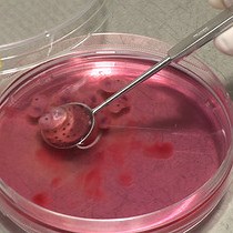 Video: Characterization of Thymic Settling Progenitors in the Mouse Embryo Using In Vivo and In Vitro Assays