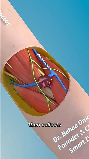 Why Your Arm Bruises After Blood Draw 🩸