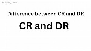 19 reactions | Difference between CR and DR system | Radiology buzz | Facebook