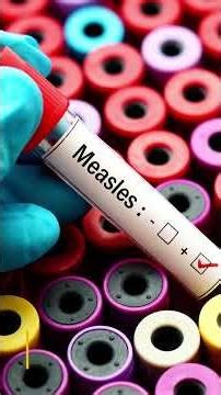 Review Article: Measles 2025