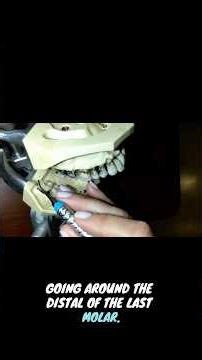 Tips for removing calculus #dentalhygiene #dentalhygienestudent #dentist