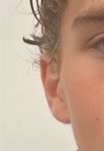 #CapCut | how to move the stickers on capcut