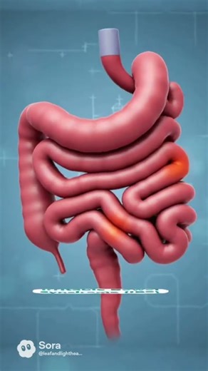 Abdominal Pain: Common Causes | 3D Medical Animation#shortvideo