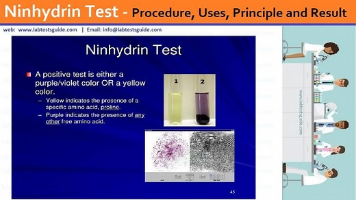 Ninhydrin Test | Lab Tests Guide