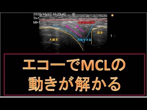 エコー動態 内側側副靭帯 自動膝関節伸展 長軸画像