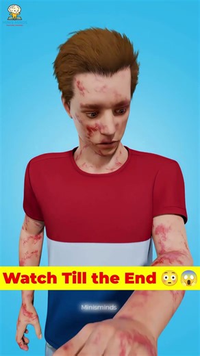 How An Ingrown Hair Put Him In A Coma #shortsfeed #facts #knowledge