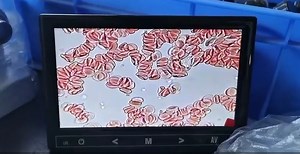 Watch Red blood cells under microscope on Amazon Live