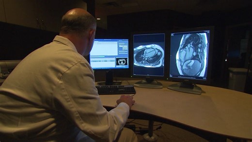 Updated heart disease guidelines aim to prevent cardiac events before they happen