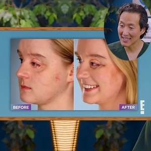 Her journey is nothing short of incredible—see how groundbreaking eye reconstruction transformed a young woman's life 🥹 | Dr. Anthony Youn