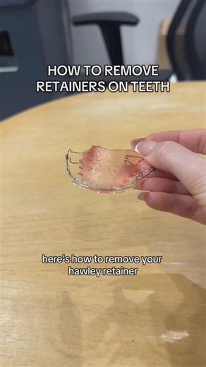 BRAMPTON & MISSISSAUGA ORTHODONTIST on Instagram: "Removing a Hawley retainer properly helps protect it from damage and ensures your teeth aren’t harmed! Bonus Tip: Don’t bite the retainer to reposition it, as this can warp the wire 🦷 Share this with someone who just got their braces off! 🔗Smilenow.com 📲Brampton (905) 789-8888 📲Mississauga (905) 949-6688 #HawleyRetainer #BracesTips #BracesOff #SmileConfidence #DreamSmileAchieved"