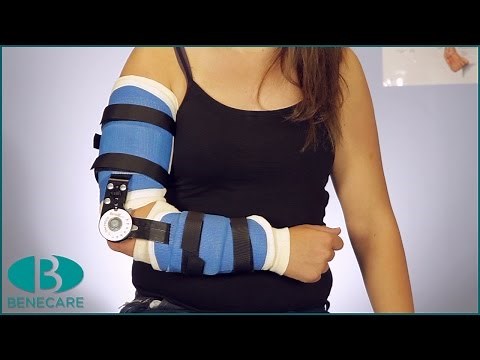 How to Apply a Hinged Elbow Brace