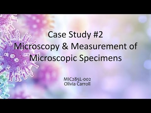 MIC285L: Case Study #2, Microscopy and Measurement of Microscopic Specimens