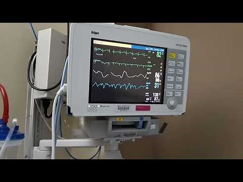 How Read PATIENT MONITOR in Hospital (Resp SpO2 Pls HR Arr NBP Alarm Meaning Use Monitoring System)