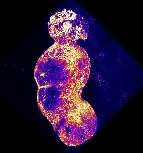 By re-creating neural pathway in dish, Stanford Medicine research may speed pain treatment – Lifeboat News: The Blog