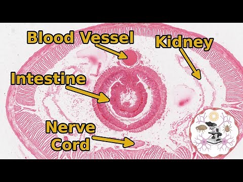 Earthworm Microscopic Anatomy - A Transverse Section