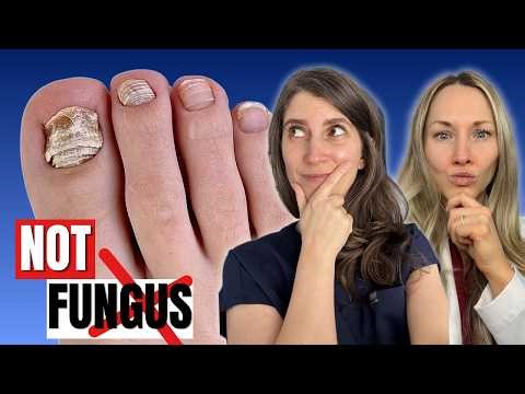 Think It’s Toenail Fungus? Watch This First